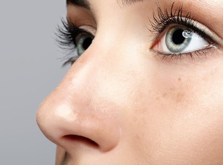 Paul Wilson Aesthetics - Rhinoplasty Procedure Video