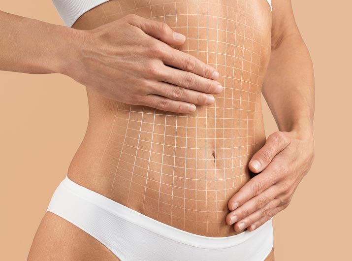 Paul Wilson Aesthetics - Abdominoplasty Procedure Video