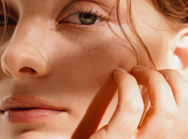 Paul Wilson Aesthetics - Deep Plane Facelift Procedure Video