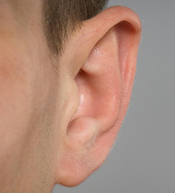 Paul Wilson Aesthetics - Ear Reshaping Treatment Overview