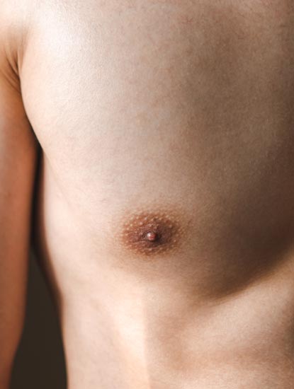 Paul Wilson Aesthetics - Male Breast Reduction Benefits 1
