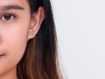 Paul Wilson Aesthetics - Prominent ears