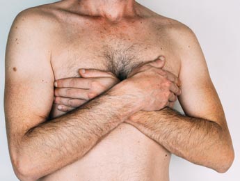 Paul Wilson Aesthetics - Pseudo gynaecomastia