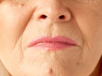 Paul Wilson Aesthetics - Rhytids